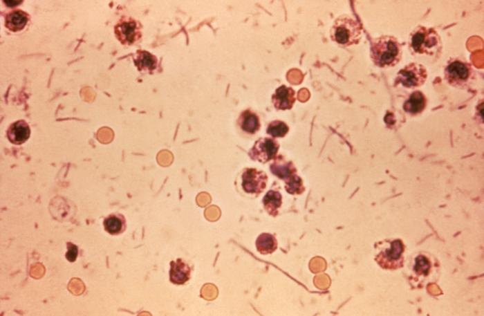 Experimental Shigella Vaccine Shows 89% Efficacy in Early Trial
