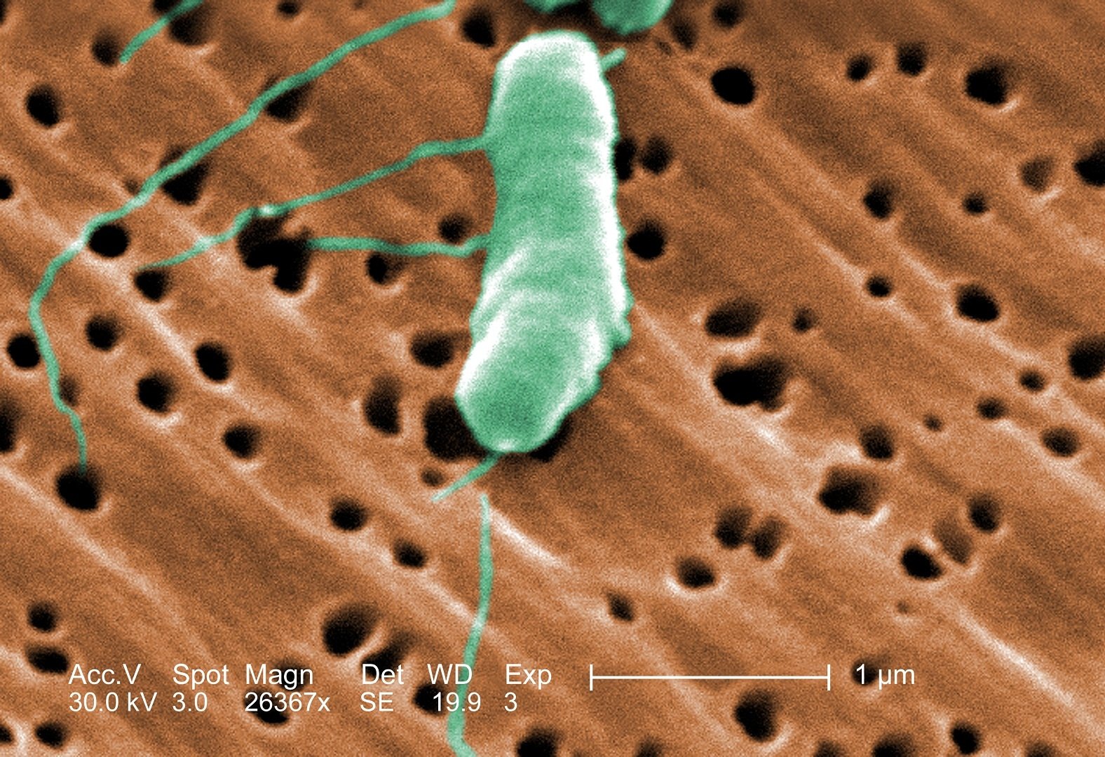 Five Dead in Louisiana This Year From Flesh-Eating Bacteria, Health Officials Say