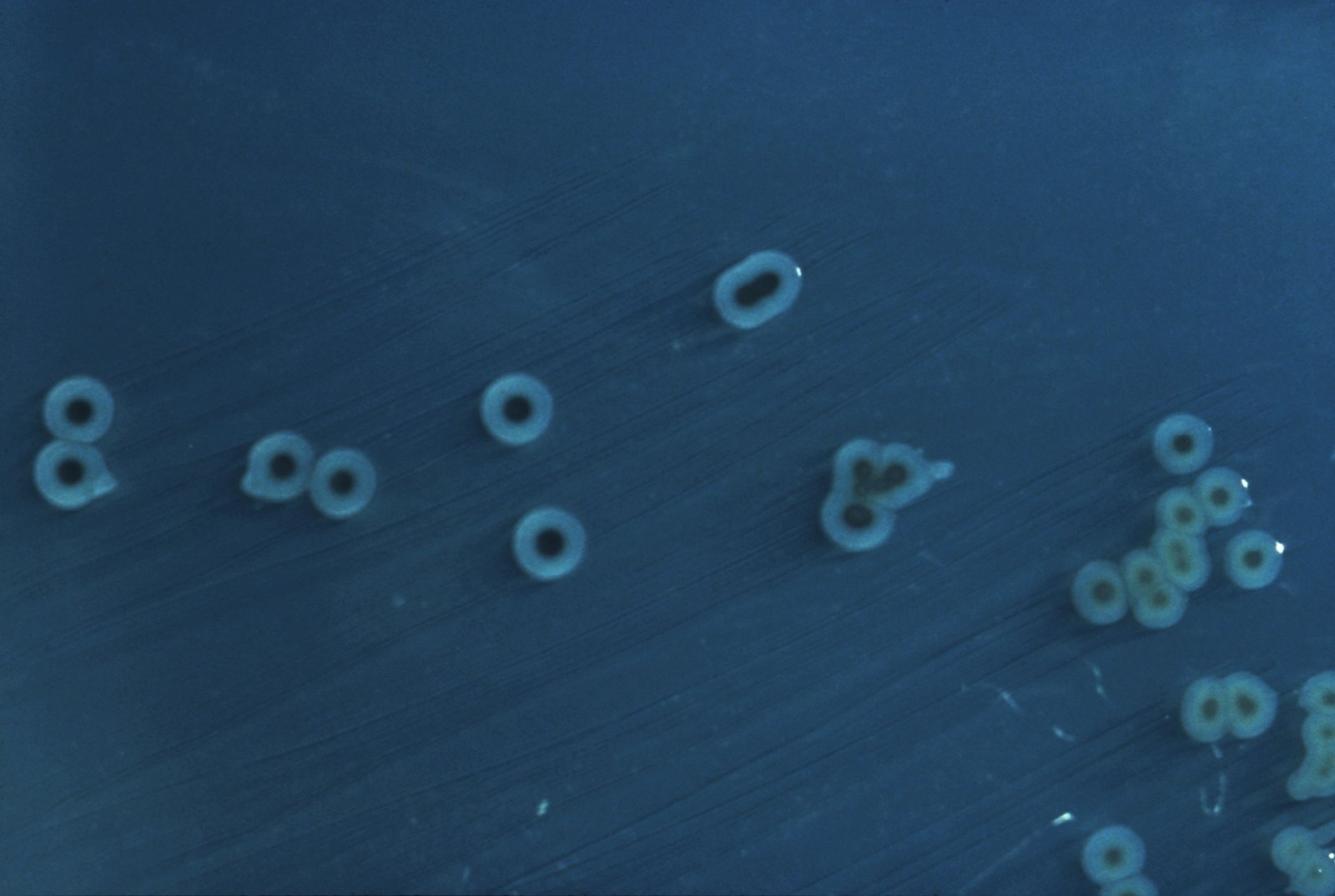 NBC Segment Asks Whether Budget Cuts Are Driving Recent Foodborne Illness Outbreaks